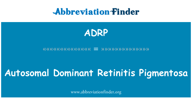 常染色体显性视网膜色素变性英文定义是Autosomal Dominant Retinitis Pigmentosa,首字母缩写定义是ADRP
